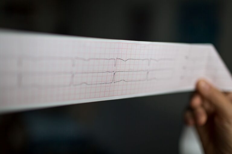 l'immagine raffigura un elettrocardiogramma e rappresenta metaforicamente il difficile equilibrio economico della farmacia dei servizi