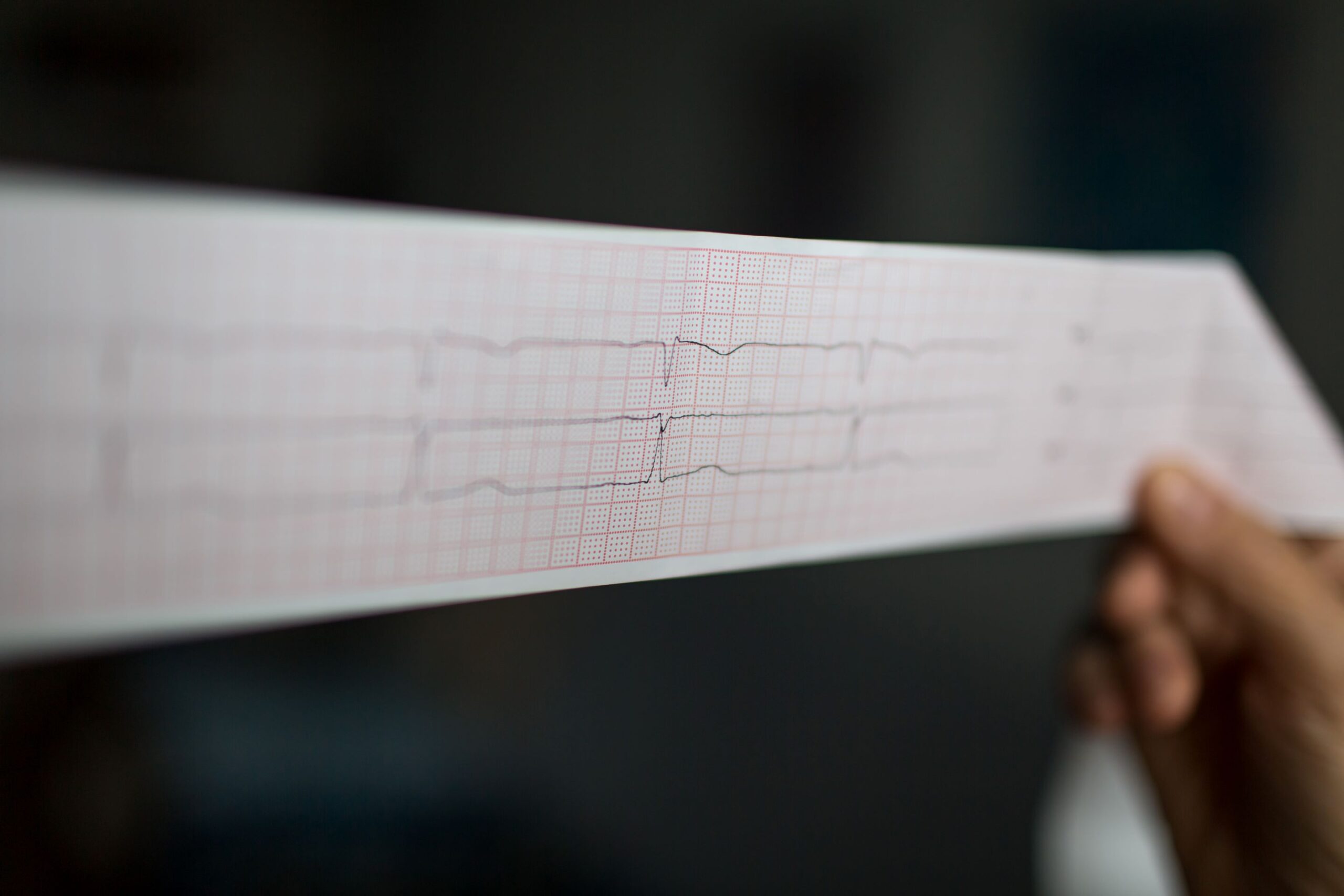 l'immagine raffigura un elettrocardiogramma e rappresenta metaforicamente il difficile equilibrio economico della farmacia dei servizi