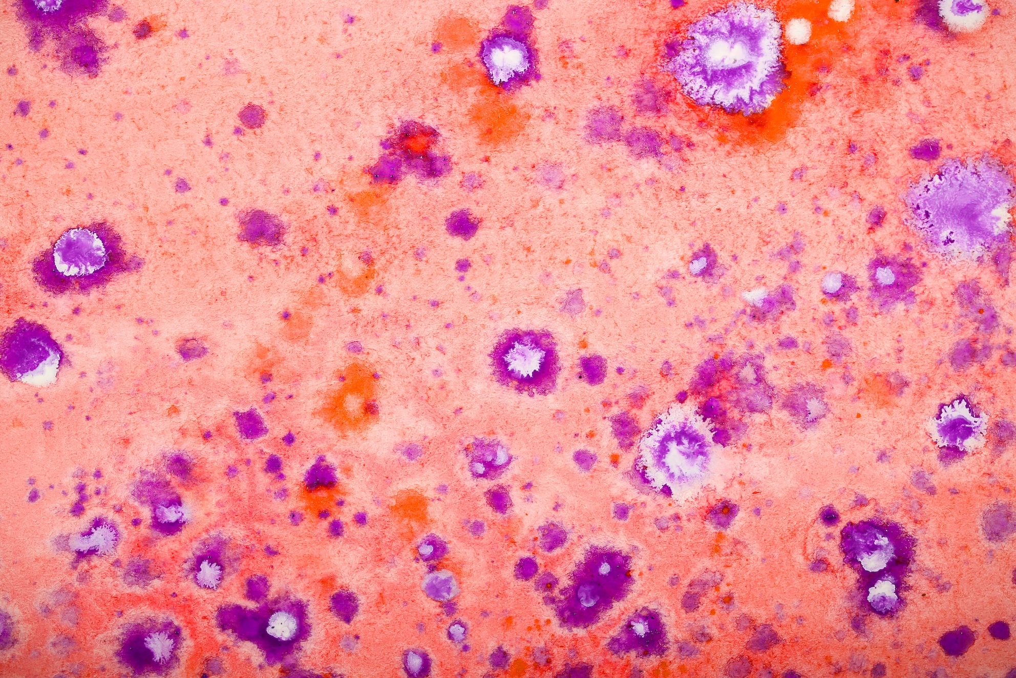 epatiti virali senza diagnosi